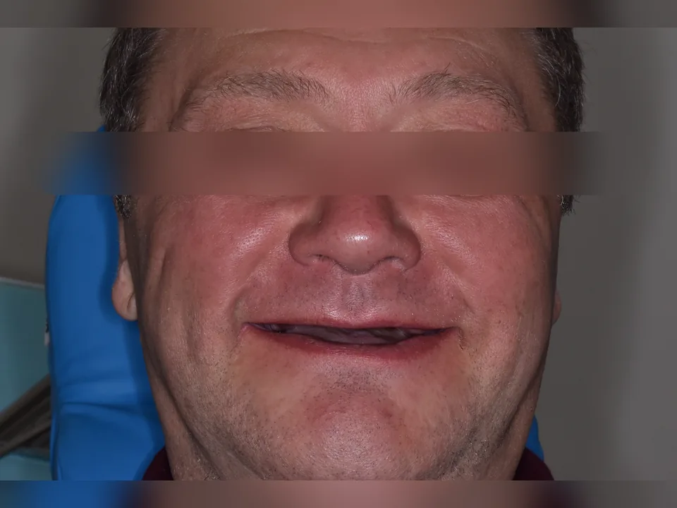 Фото до лечения, кейс №2